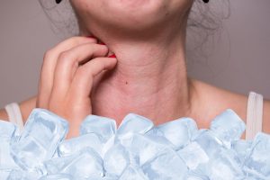 Read more about the article Nước đá sạch có giúp giảm ngứa do dị ứng da? Cách chườm đúng cách